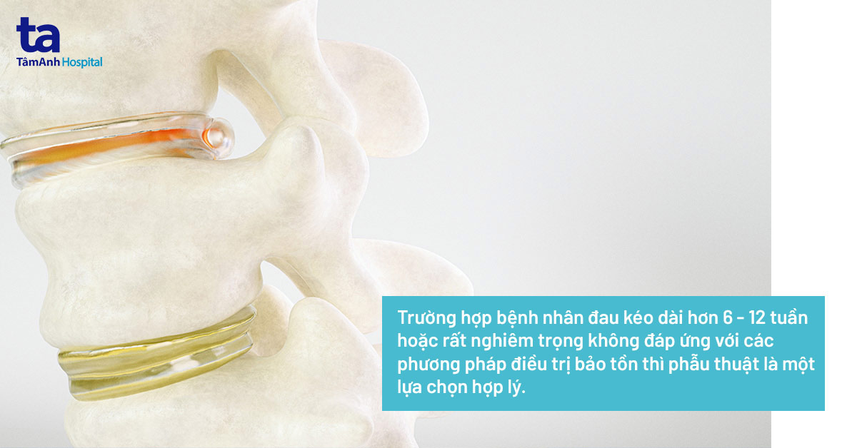 Phẫu thuật thoát vị đĩa đệm cột sống thắt lưng L4 L5, L5 S1