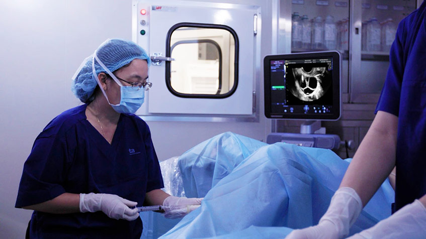 Thạc sĩ, bác sĩ Giang Huỳnh Như - Giám đốc Trung tâm Hỗ trợ sinh sản BVĐK Tâm Anh TP.HCM đang chọc hút noãn cho bệnh nhân VSHM, tháng 9/2021