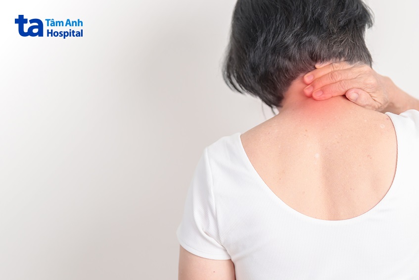 bệnh thoái hóa cột sống ở cổ