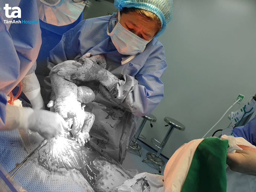 ca bệnh thoát vị rốn