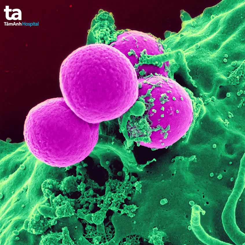 thông tin về vi khuẩn staphylococcus aureus
