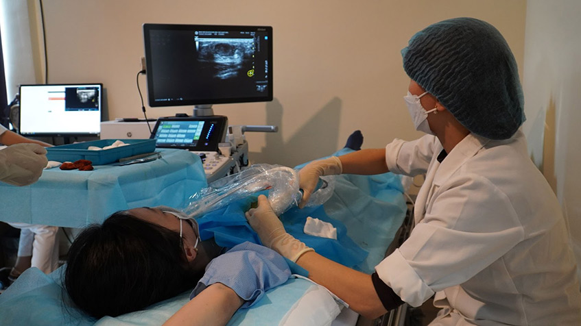 Ca điều trị u xơ tại tâm anh