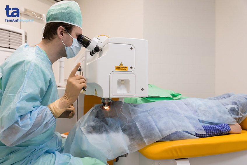 cườm nước tăng nhãn áp