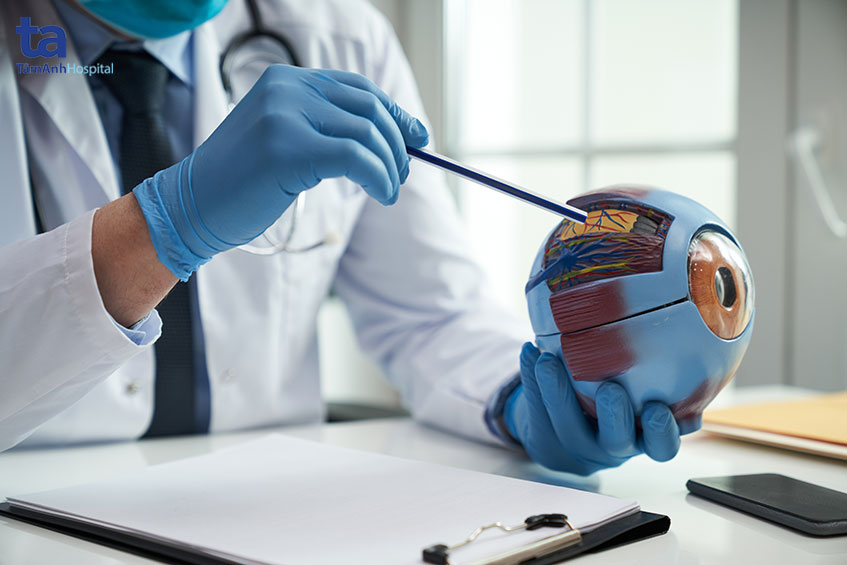 cườm nước tăng nhãn áp