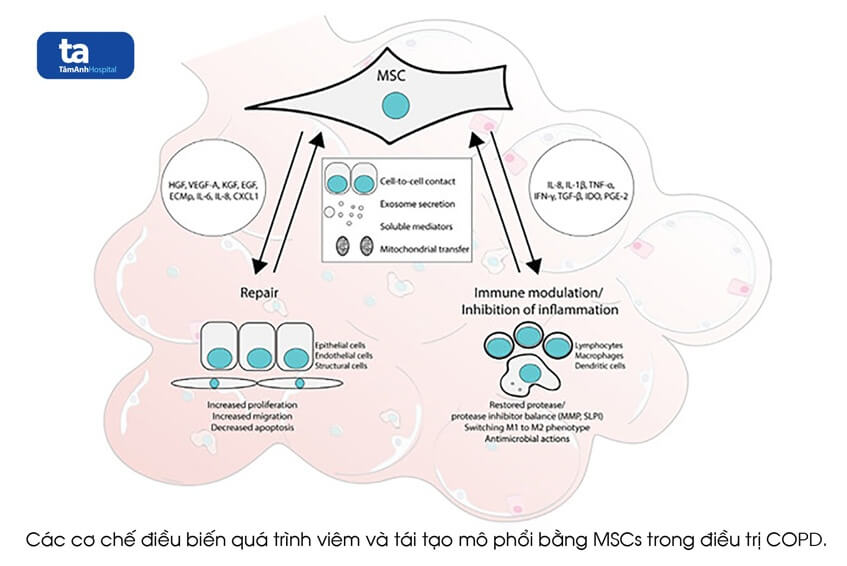 điều trị copd bằng tế bào gốc mscs