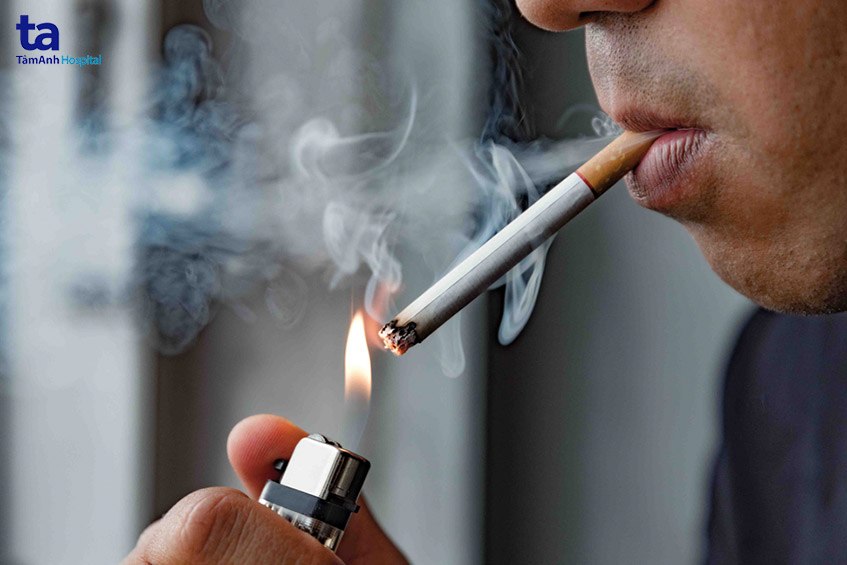 điều trị ung thư thanh quản