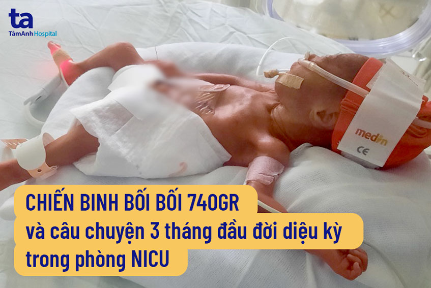 Giờ vàng cứu trẻ sinh non