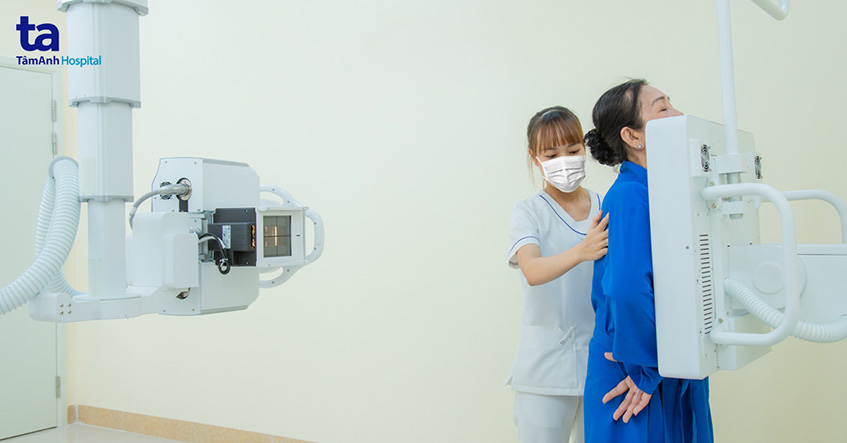 Phương pháp phát hiện sớm, điều trị hiệu quả ung thư phổi 