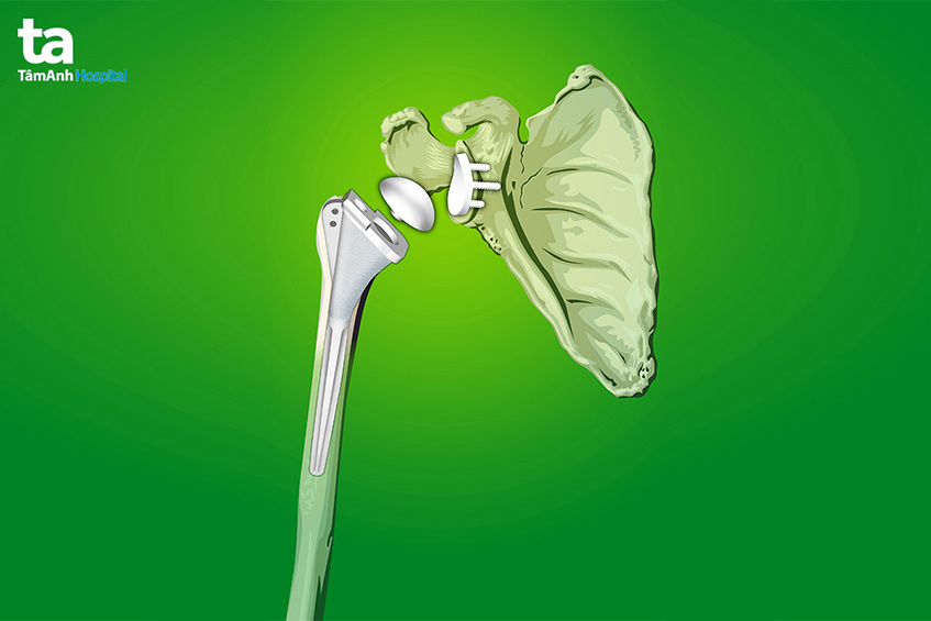 Rủi ro khi thực hiện phẩu thuật