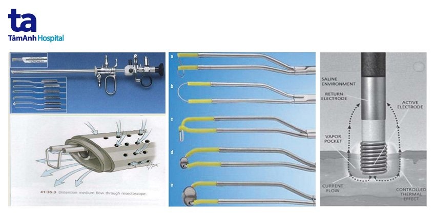 Thiết bị cắt đốt nội soi buồng tử cung (hình bên trái) với đầu là dao điện đơn cực (hình giữa) và dao điện lưỡng cực (hình bên phải).