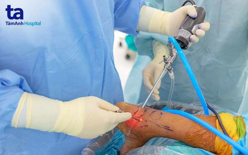 quy trình phẫu thuật