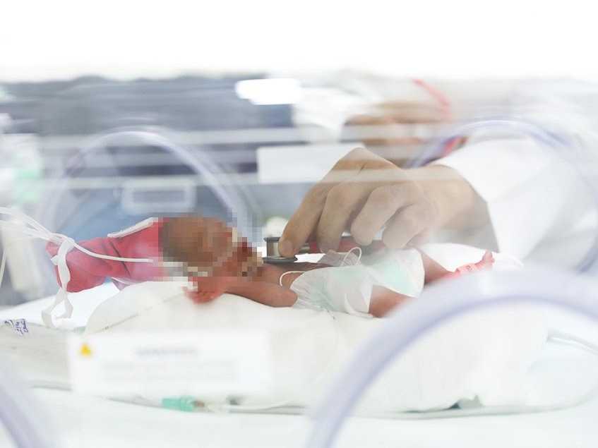 Trẻ sinh cực non ở 25 tuần thai