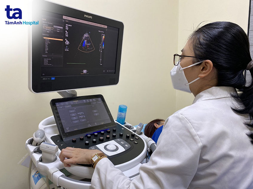 máy siêu âm tim