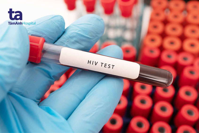 bệnh nhân hiv