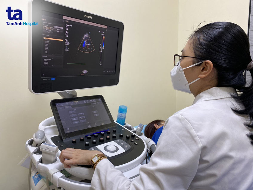 siêu âm tim định kỳ
