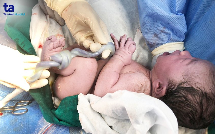 bác sĩ bất ngờ phát hiện nút thắt chết người