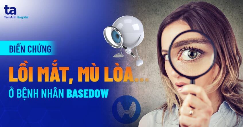 bien chung benh basedow