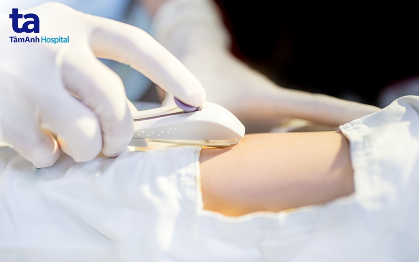 Cấy que tránh thai là một biện pháp tránh thai khá hiệu quả