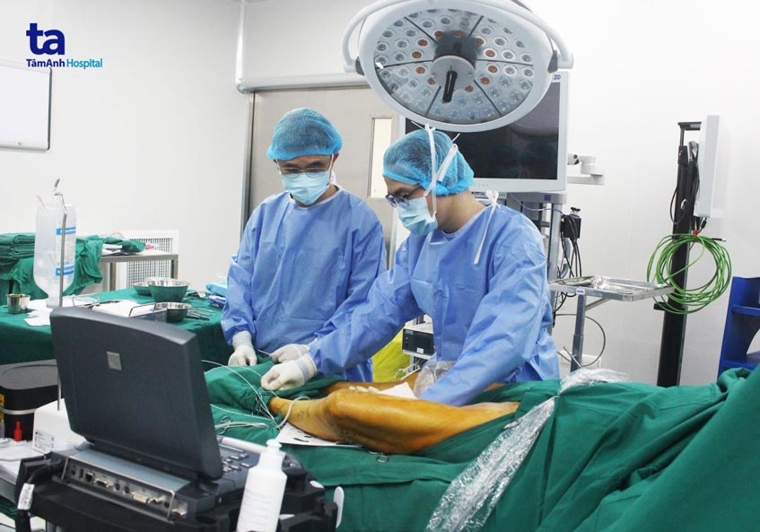 laser đốt tĩnh mạch