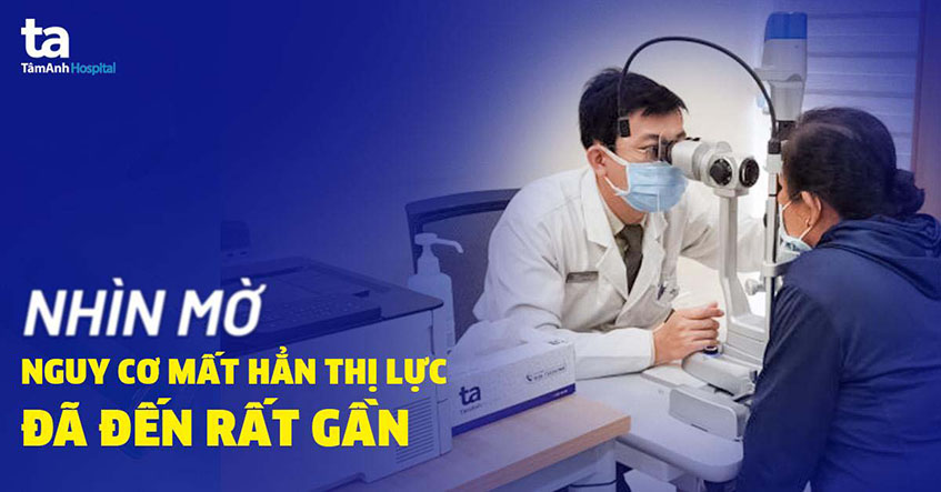 bien chung mat bi nhin mo