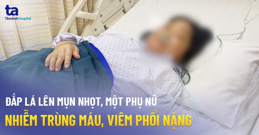 cap cuu phu nu nhiem trung mau viem phoi nang