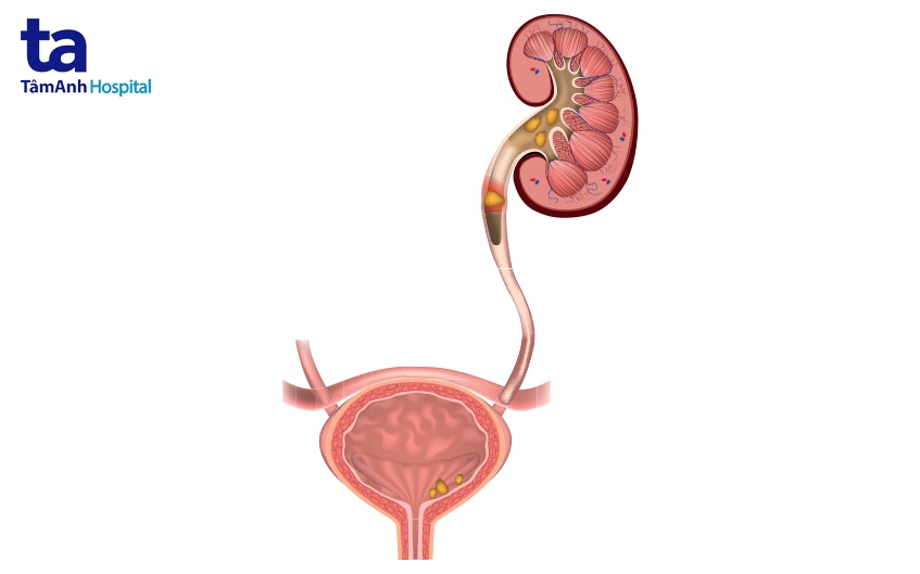 chẩn đoán cận lâm sàn