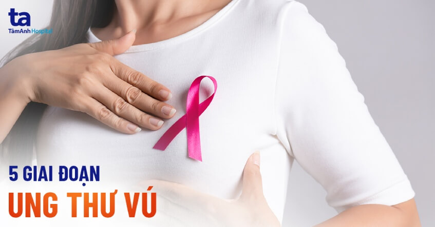 Ung thư vú: Việc kiểm tra ung thư vú thường xuyên sẽ giúp chúng ta phát hiện bệnh sớm và đưa ra biện pháp phòng chống kịp thời. Hãy cùng xem hình ảnh và tìm hiểu thêm về căn bệnh này để giữ gìn sức khỏe chính mình và người thân.