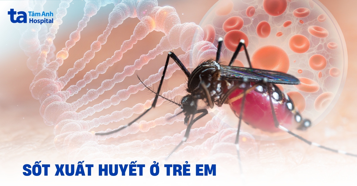 Sốt Xuất Huyết Ở Trẻ Em