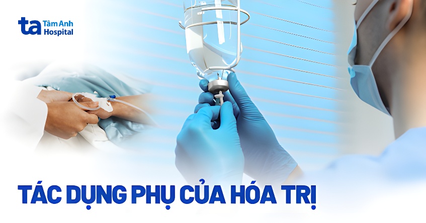 14 tác dụng phụ của hóa trị ung thư bằng hóa chất có thể xảy ra