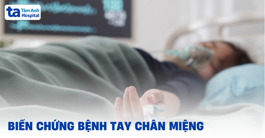 biến chứng bệnh tay chân miệng