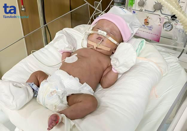 bống được chăm sóc tích cực trong nicu