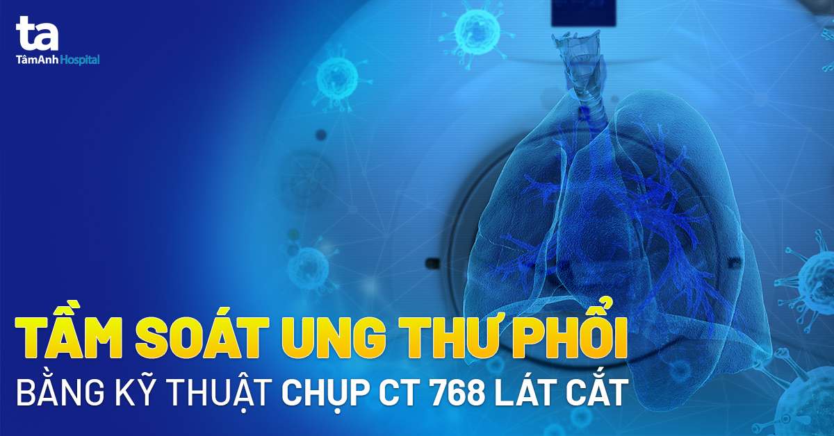 Tầm soát ung thư phổi bằng kỹ thuật chụp CT 768 lát cắt