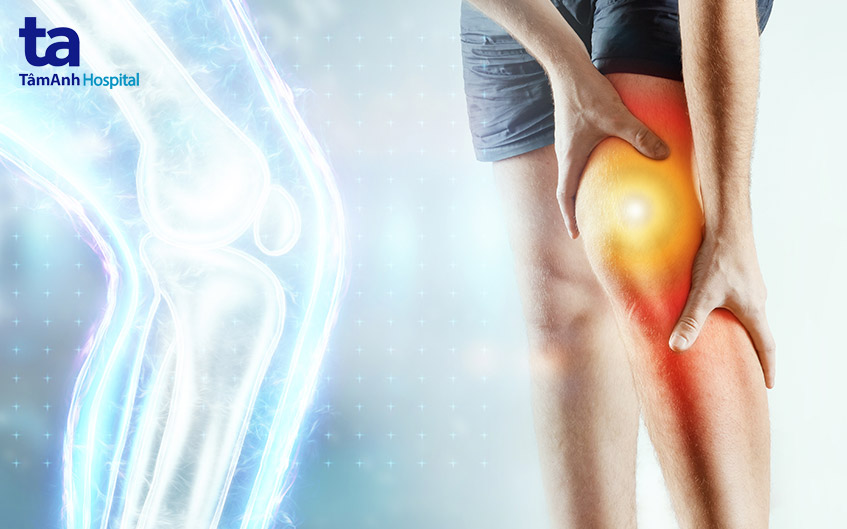 100 loại viêm khớp