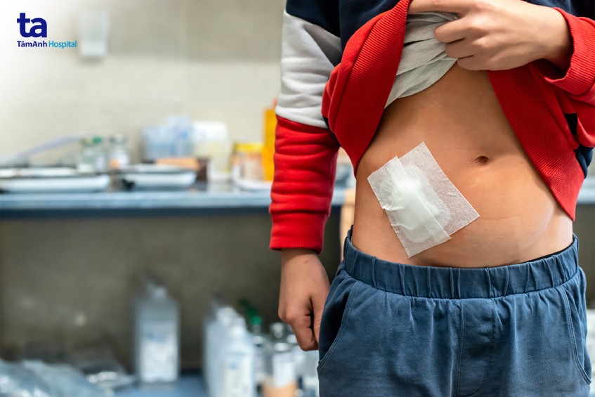 Biến chứng táo bón ở trẻ