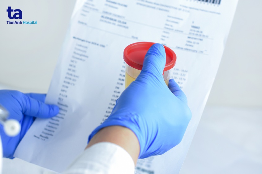 chuẩn đoán viêm bàng quang cấp