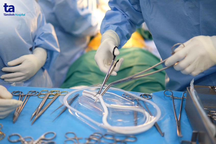 chuẩn bị ống ghép mạch nhân tạo