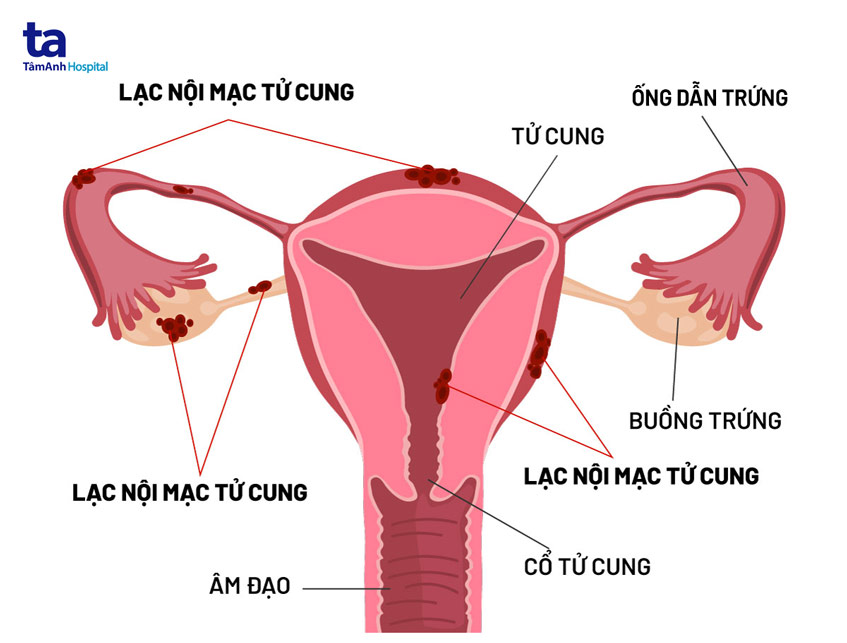 cơ quan sinh sản của bệnh nhân