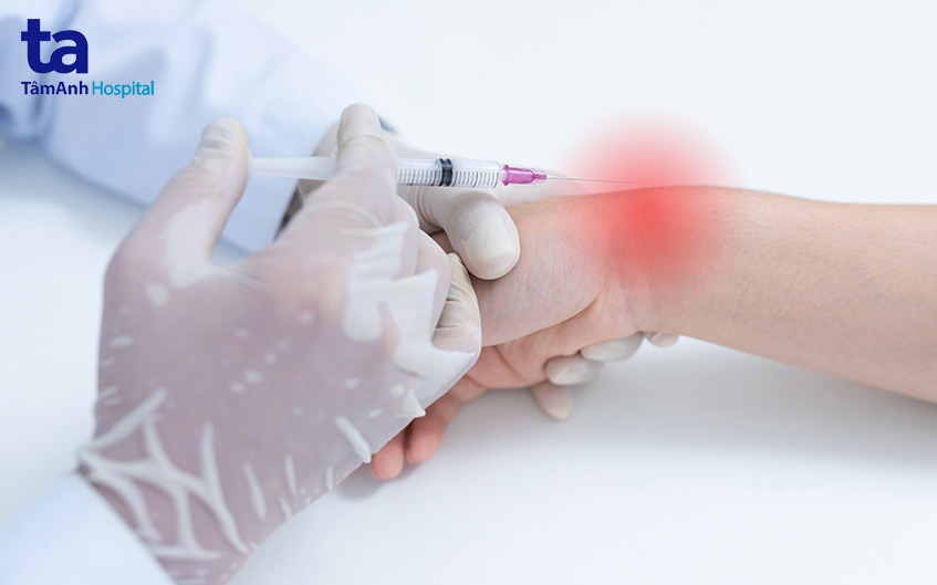 lưu ý khi tiêm khớp tay