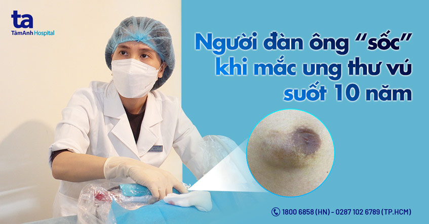 Người đàn ông “sốc” khi mắc ung thư vú suốt 10 năm