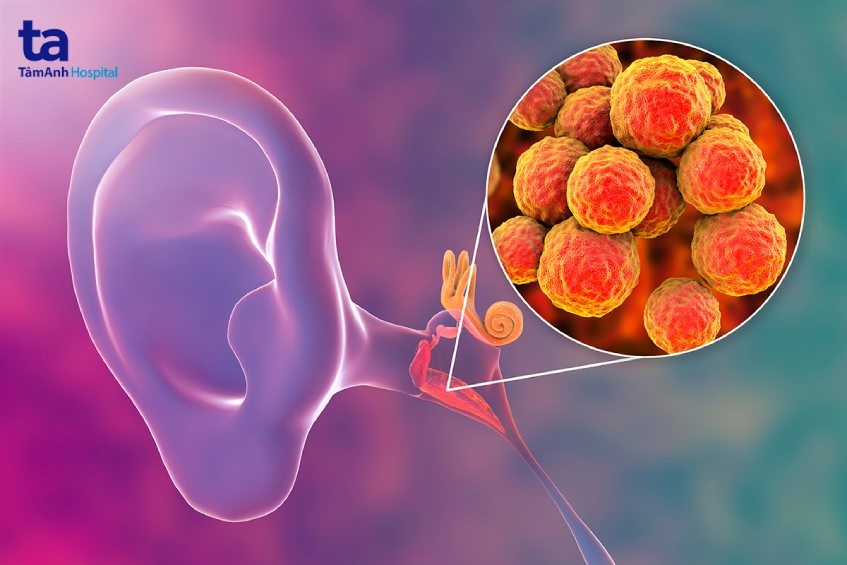 nhiễm trùng tai biến chứng amidan