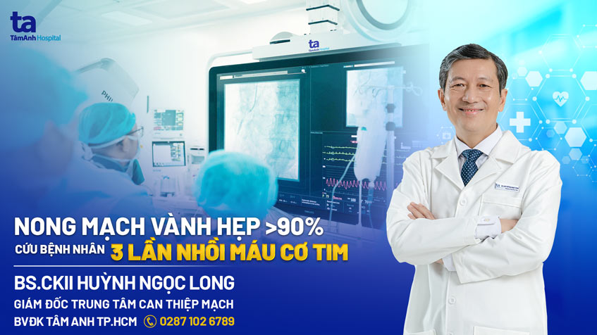 Nong mạch vành hẹp hơn 90% cho bệnh nhân 3 lần nhồi máu cơ tim