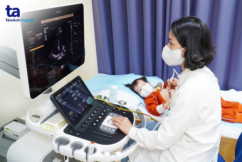 siêu âm tim cho bệnh nhi