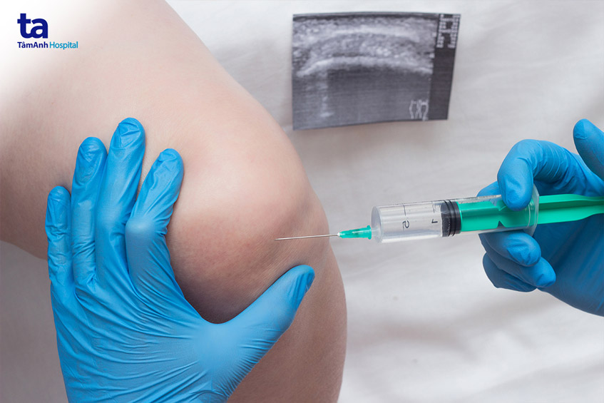 tiến hành tiêm khớp