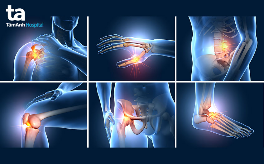tổng quan về thoái hóa khớp
