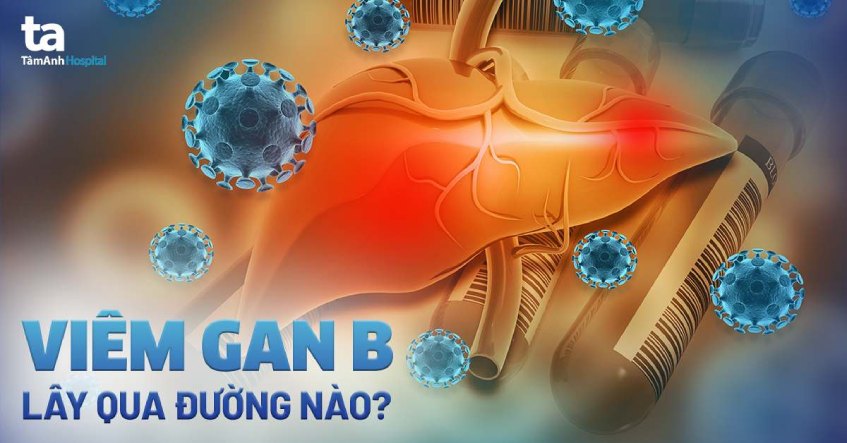 Viêm gan B có lây không? Lây qua đường nào và phòng tránh