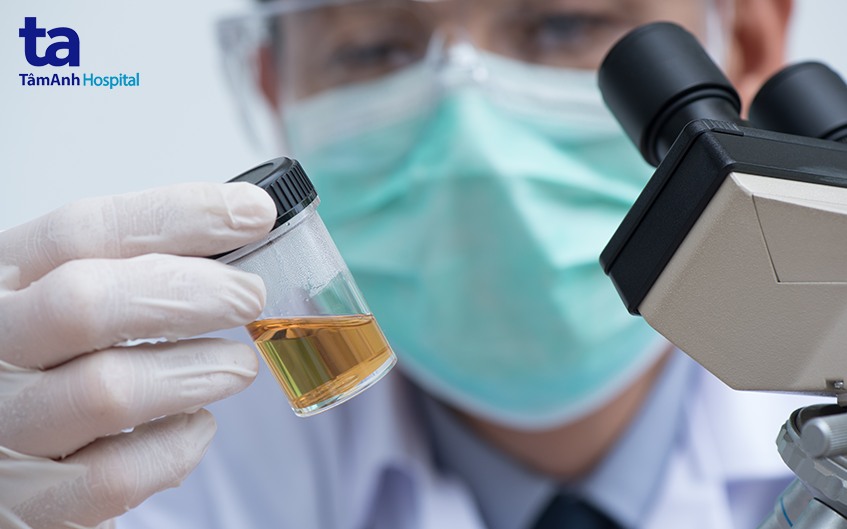 xét nghiệm máu và nước tiểu