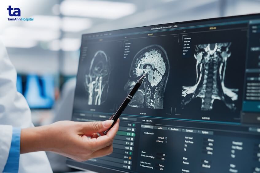 chẩn đoán nguyên nhân đau nửa đầu sau