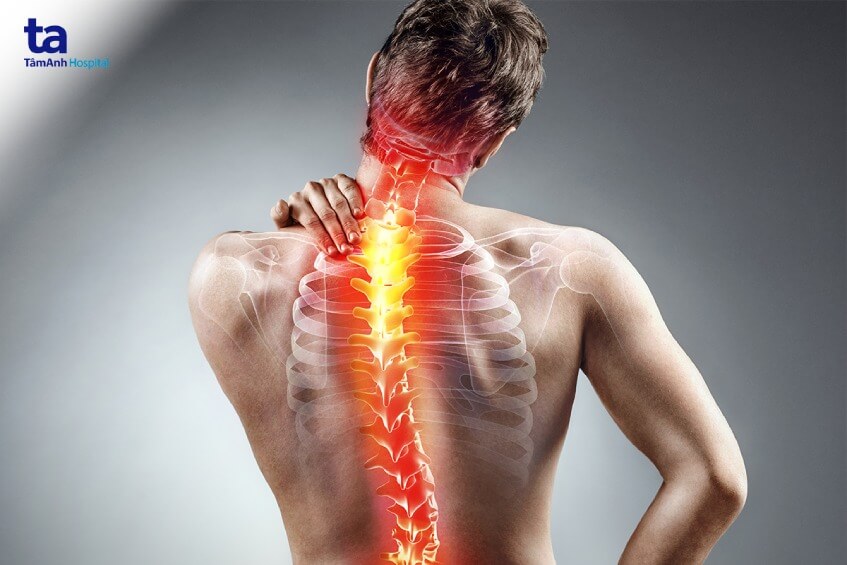 đau nhức nửa đầu sau