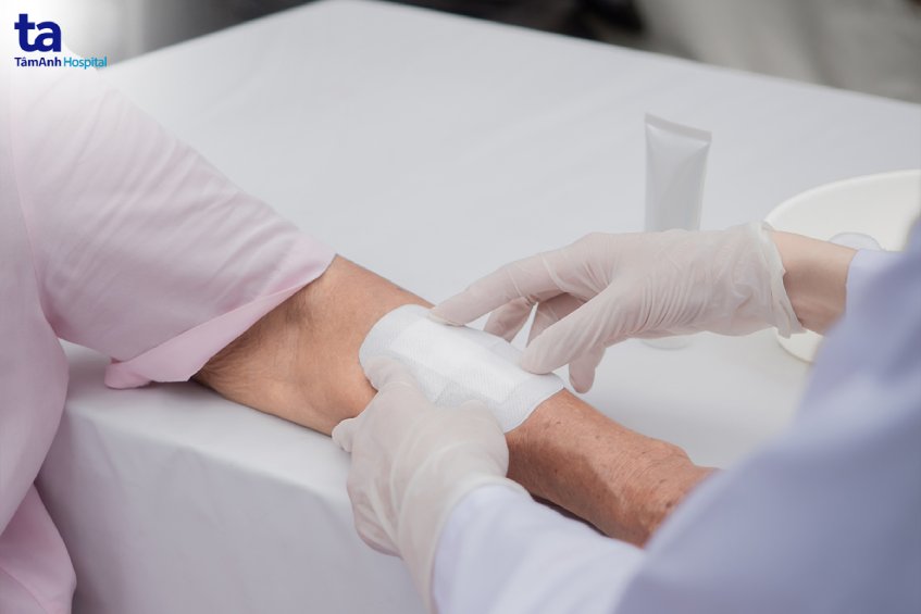 điều trị vết thương ở người bệnh đái tháo đường