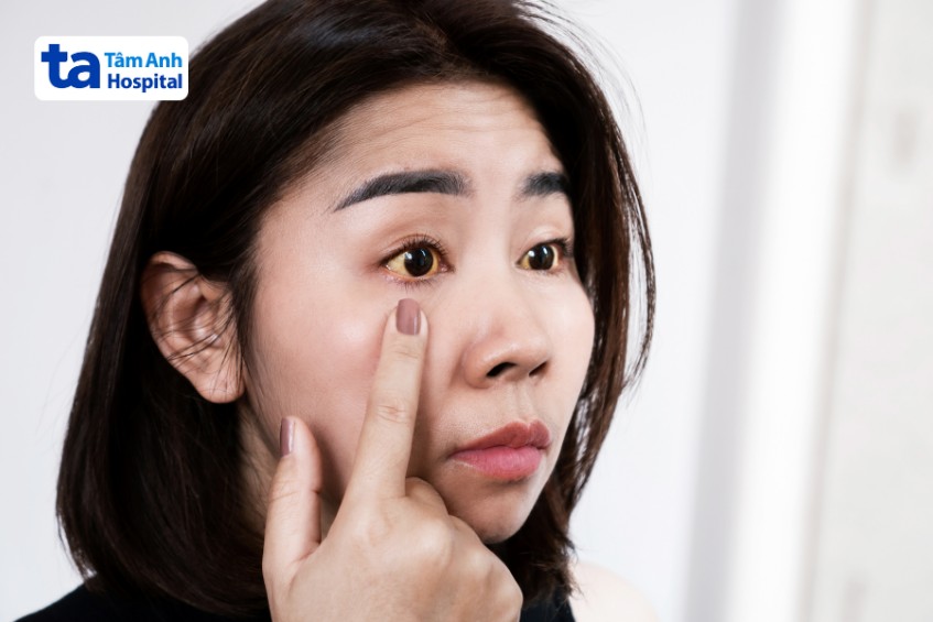 khám viêm gan mạn